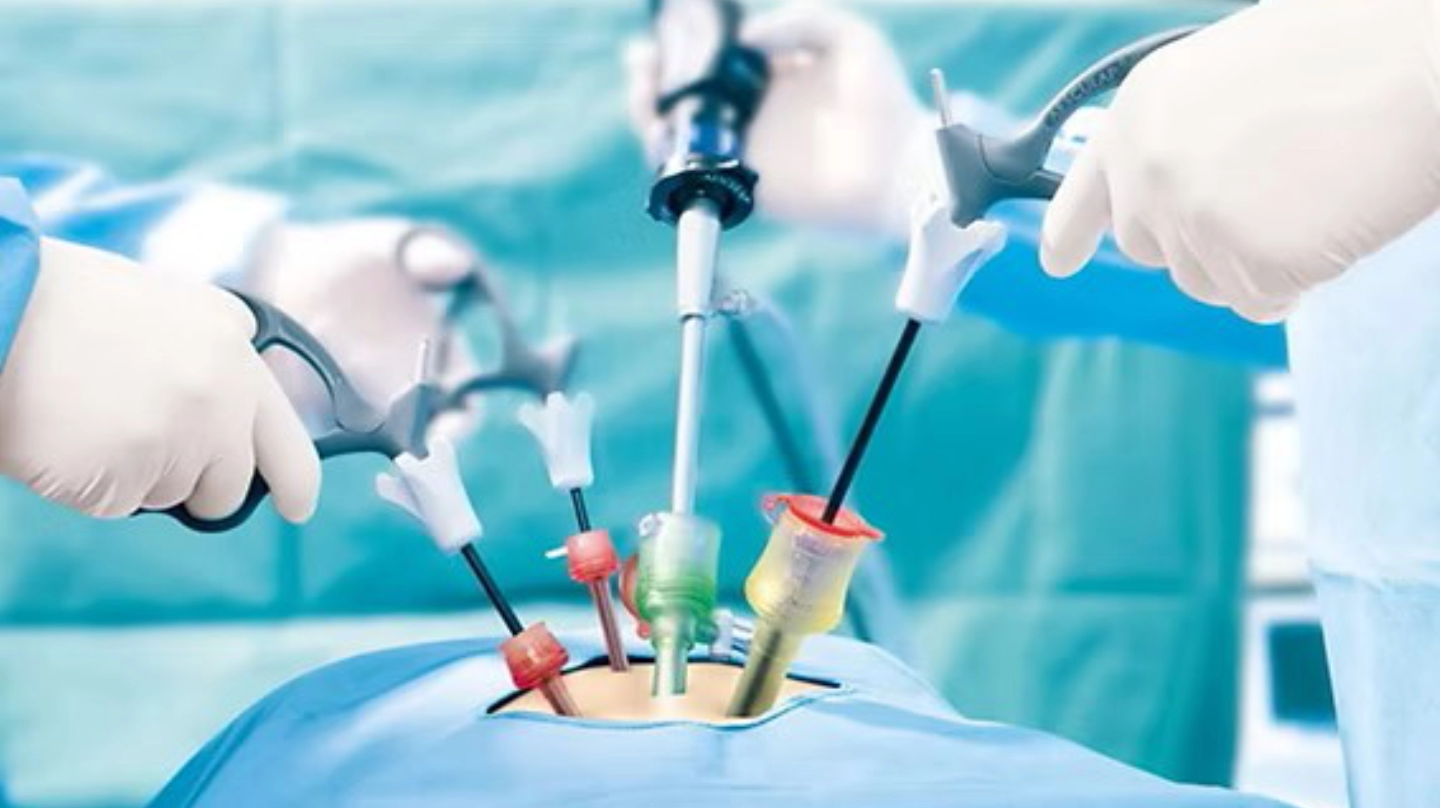 Advanced Laparoscopic Surgery
